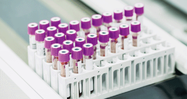 検体ラベルイメージ