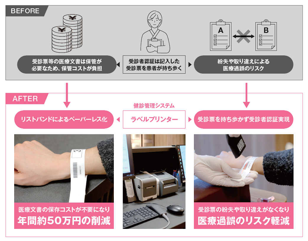 Before After